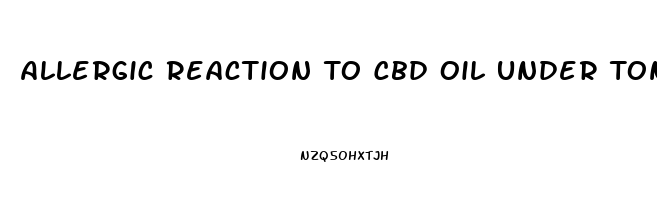 Allergic Reaction To Cbd Oil Under Tongue