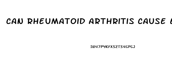 Can Rheumatoid Arthritis Cause Erectile Dysfunction
