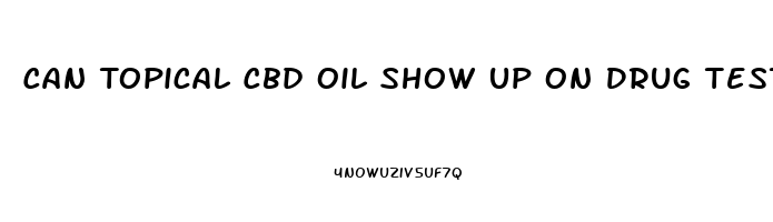 Can Topical Cbd Oil Show Up On Drug Test