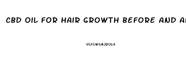 Cbd Oil For Hair Growth Before And After