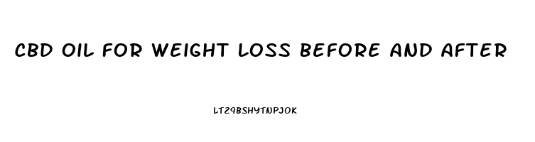 Cbd Oil For Weight Loss Before And After