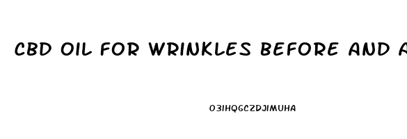 Cbd Oil For Wrinkles Before And After