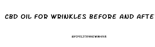 Cbd Oil For Wrinkles Before And After