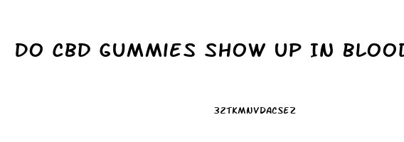 Do Cbd Gummies Show Up In Bloodwork