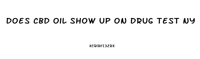 Does Cbd Oil Show Up On Drug Test Ny