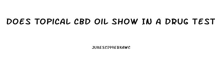 Does Topical Cbd Oil Show In A Drug Test