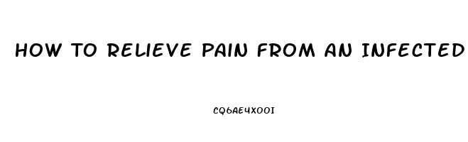 How To Relieve Pain From An Infected Tooth