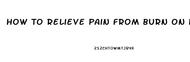 How To Relieve Pain From Burn On Hand