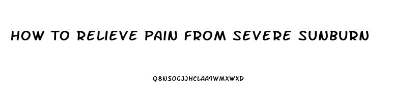 How To Relieve Pain From Severe Sunburn