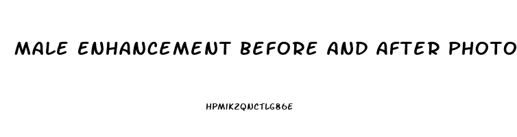 Male Enhancement Before And After Photos