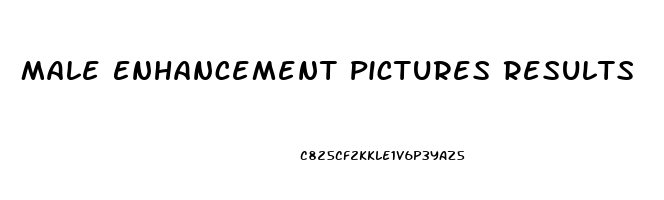 Male Enhancement Pictures Results