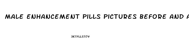 Male Enhancement Pills Pictures Before And After