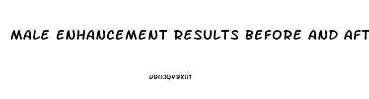 Male Enhancement Results Before And After