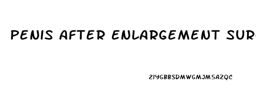 Penis After Enlargement Surgery