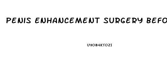 Penis Enhancement Surgery Before And After