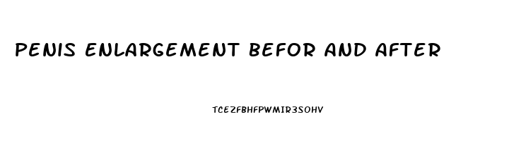 Penis Enlargement Befor And After