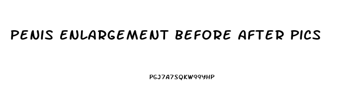 Penis Enlargement Before After Pics