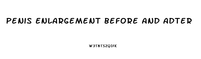 Penis Enlargement Before And Adter