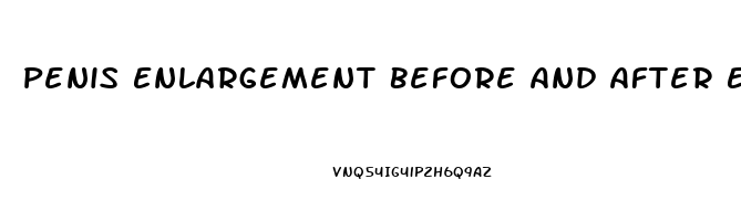 Penis Enlargement Before And After Erect