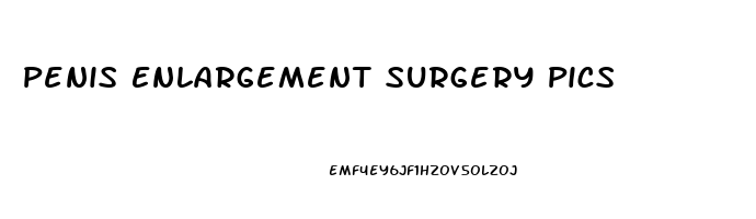 Penis Enlargement Surgery Pics