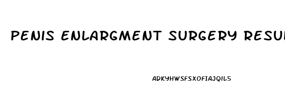 Penis Enlargment Surgery Results