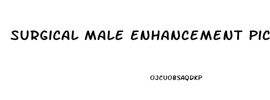 Surgical Male Enhancement Pictures