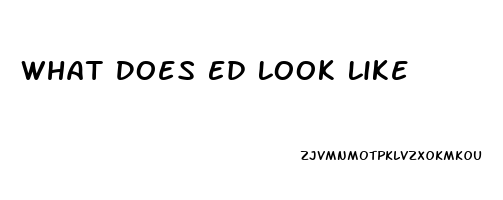 What Does Ed Look Like