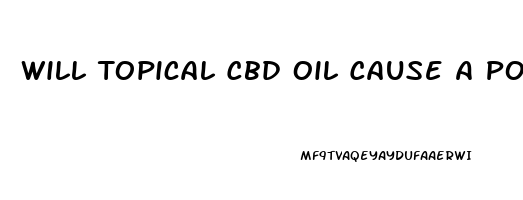 Will Topical Cbd Oil Cause A Positive Drug Test