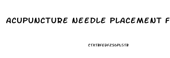 acupuncture needle placement for erectile dysfunction