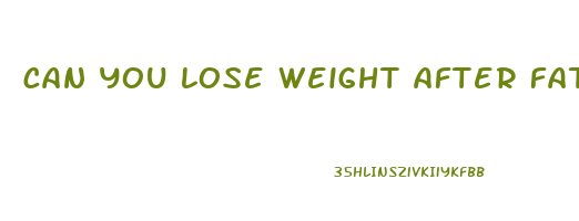 can you lose weight after fat transfer