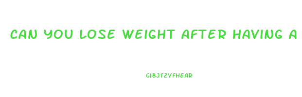 can you lose weight after having a hysterectomy