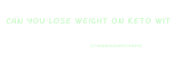 can you lose weight on keto without a calorie deficit