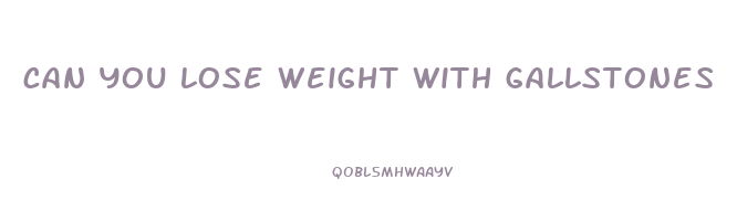 can you lose weight with gallstones