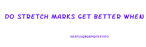 do stretch marks get better when you lose weight