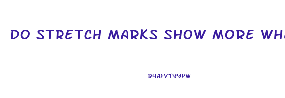 do stretch marks show more when you lose weight