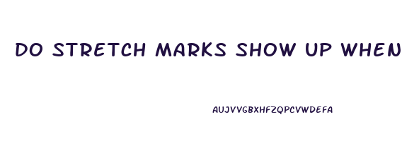 do stretch marks show up when you lose weight