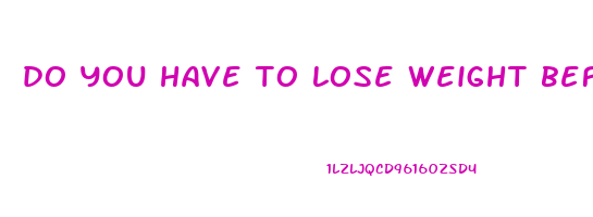 do you have to lose weight before gastric bypass
