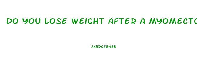 do you lose weight after a myomectomy