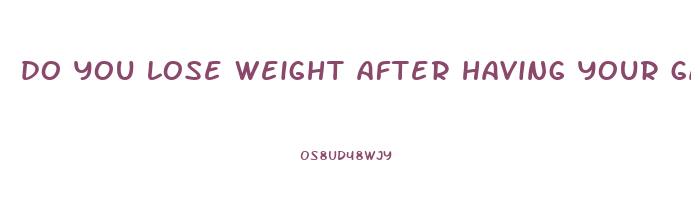 do you lose weight after having your gallbladder removed