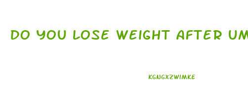 do you lose weight after umbilical hernia surgery