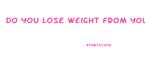 do you lose weight from your face first