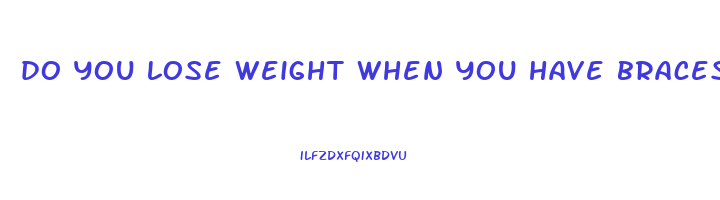do you lose weight when you have braces