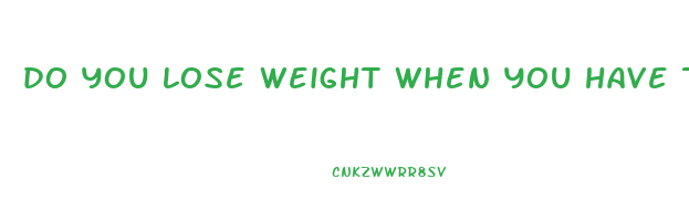 do you lose weight when you have the flu