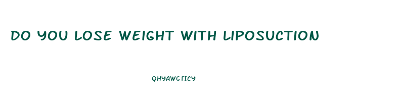 do you lose weight with liposuction