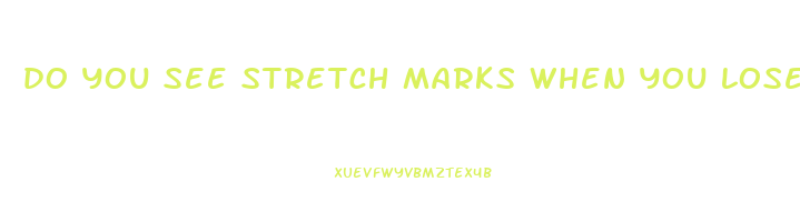 do you see stretch marks when you lose weight