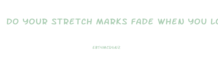 do your stretch marks fade when you lose weight