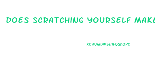 does scratching yourself make u lose weight