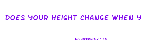 does your height change when you lose weight