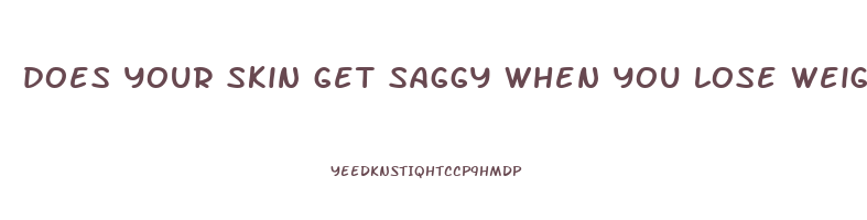 does your skin get saggy when you lose weight