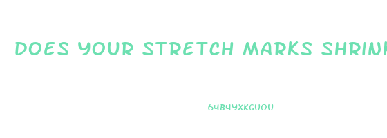 does your stretch marks shrink when you lose weight